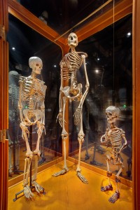Compare and Contrast: Giant, dwarf, and average human skeletons.